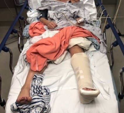 Patient in hospital bed with splint on left foot